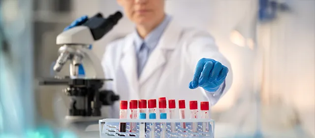 Integrating AI and Predictive Biomarkers in Prostate Cancer Care